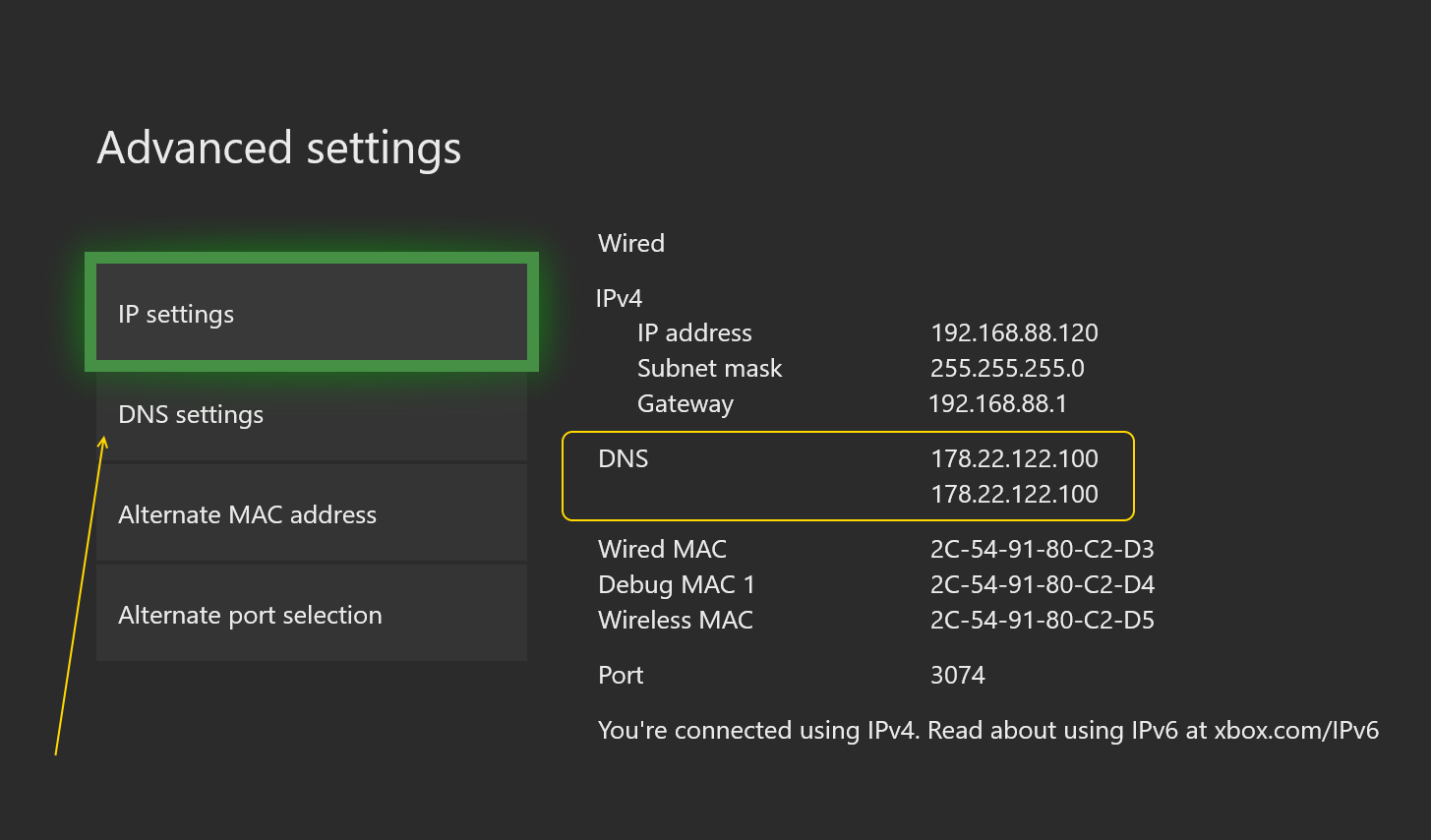 Ip адрес игр. Xbox one s DNS. Xbox DNS сервер. Xbox IP address. DNS сервер Xbox one.